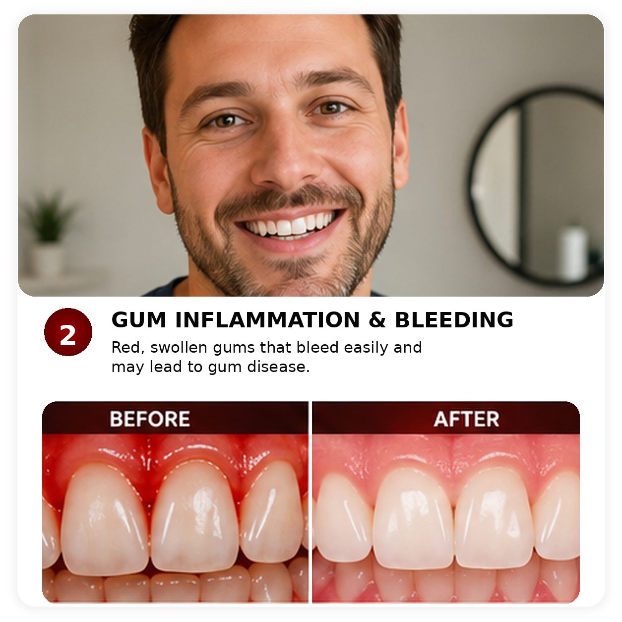 Illustrative before and after comparison related to red and irritated gums