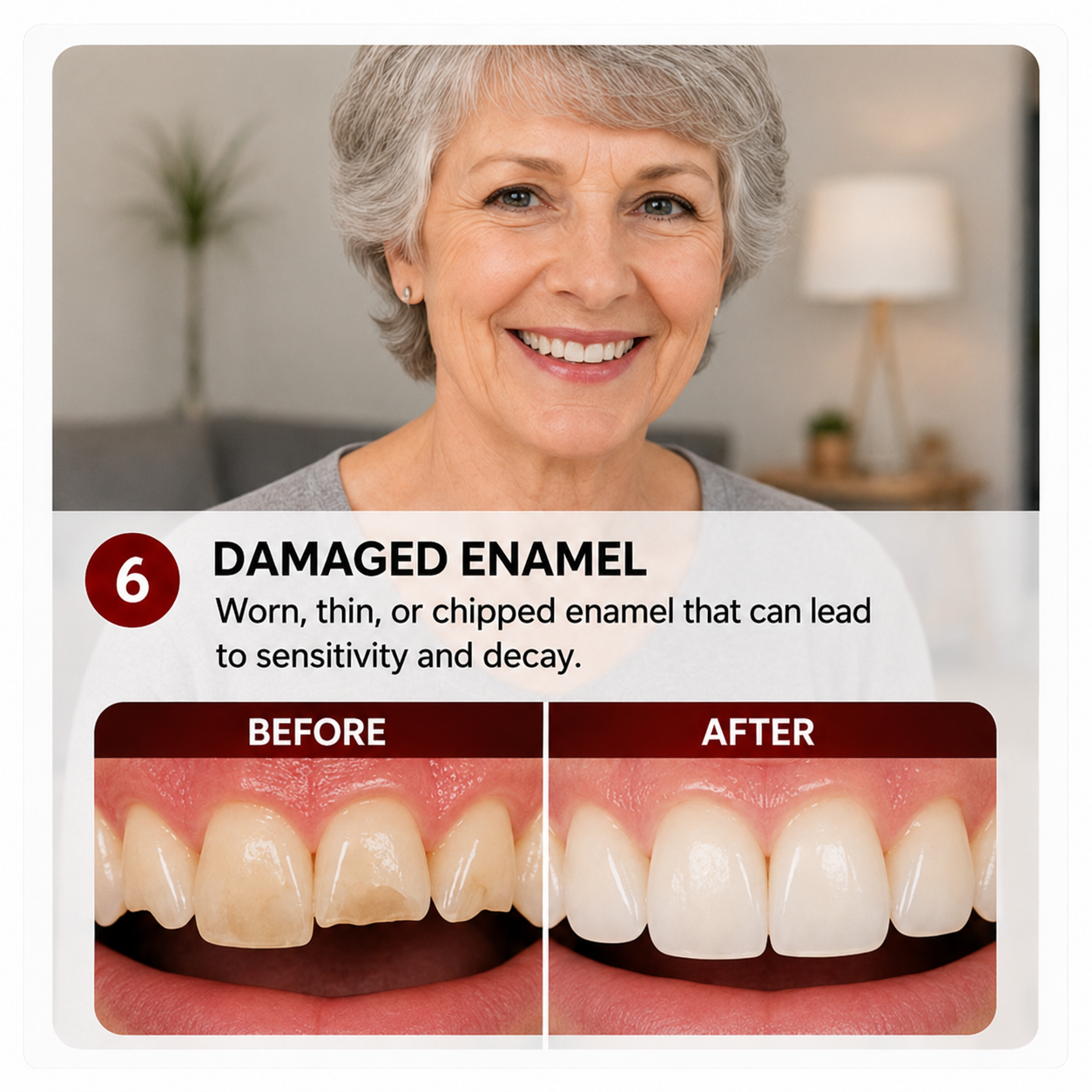 Illustrative comparison related to worn or damaged-looking enamel