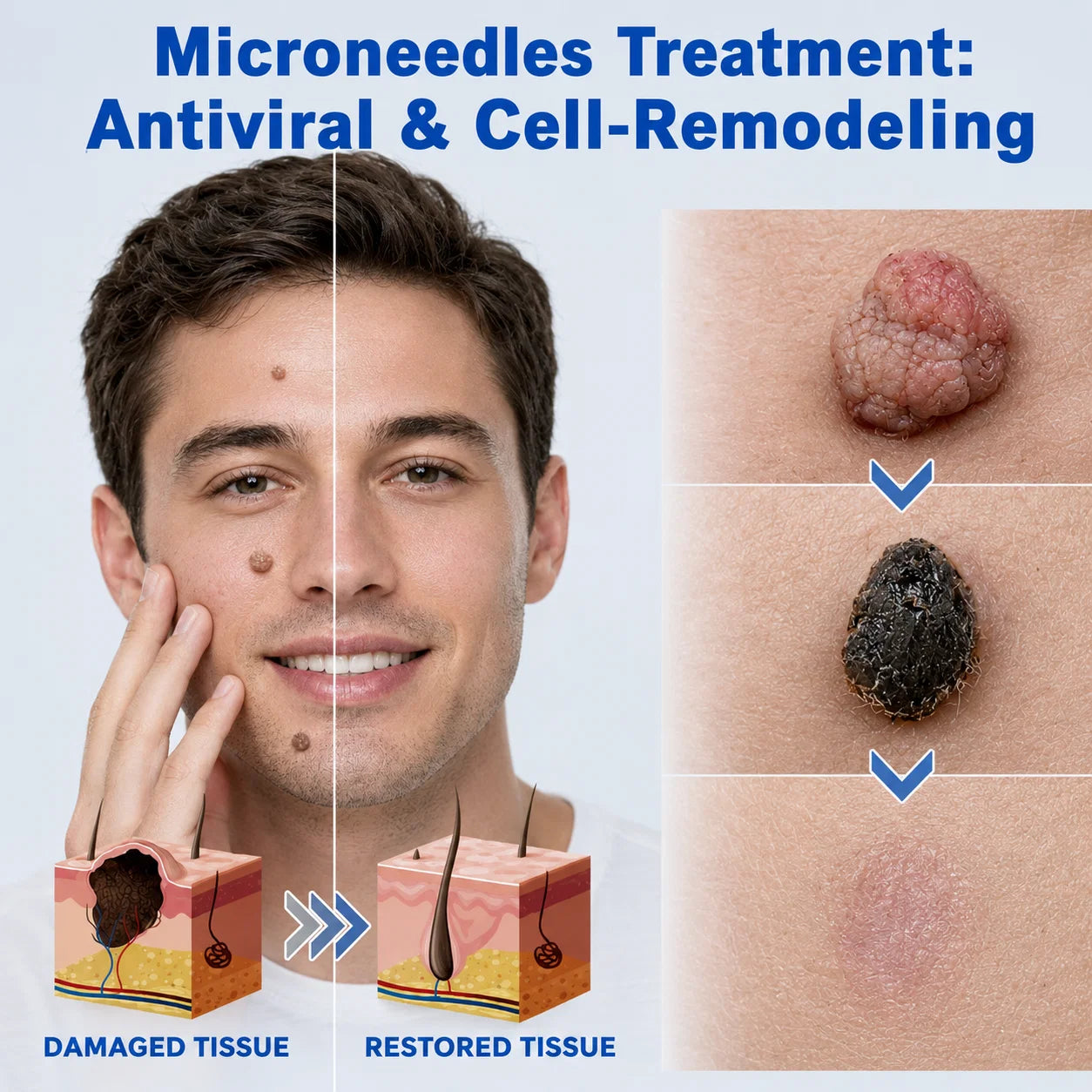 Targeted microneedle skin care illustration