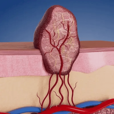 Microneedle targeted spot care illustration