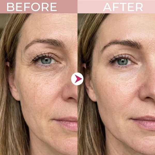 ⏳🔥Last Day-Buy 1 Get 1 Free🔥⏰P7 Eye Renewal Crème