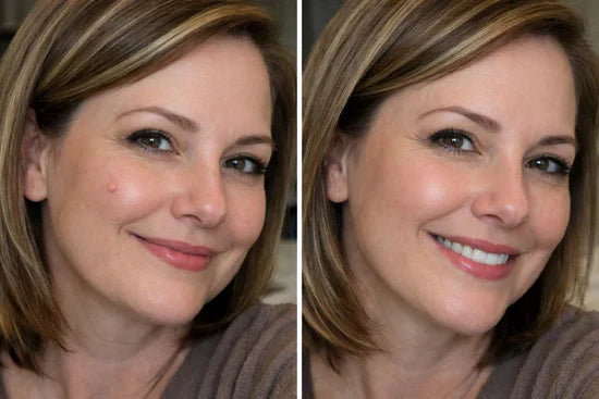 Customer before and after result