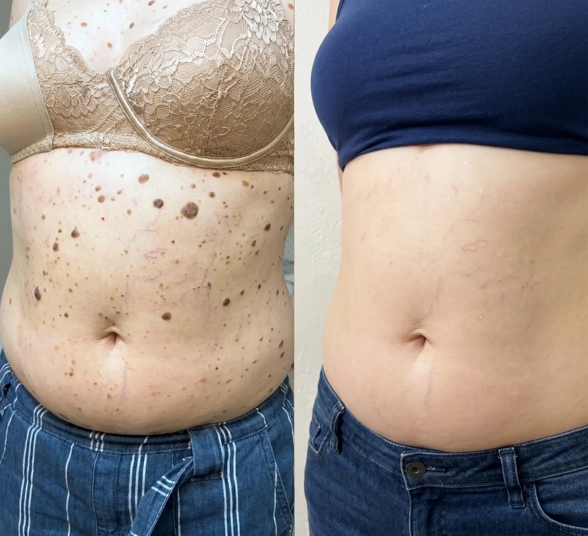 Customer before and after comparison showing body skin
