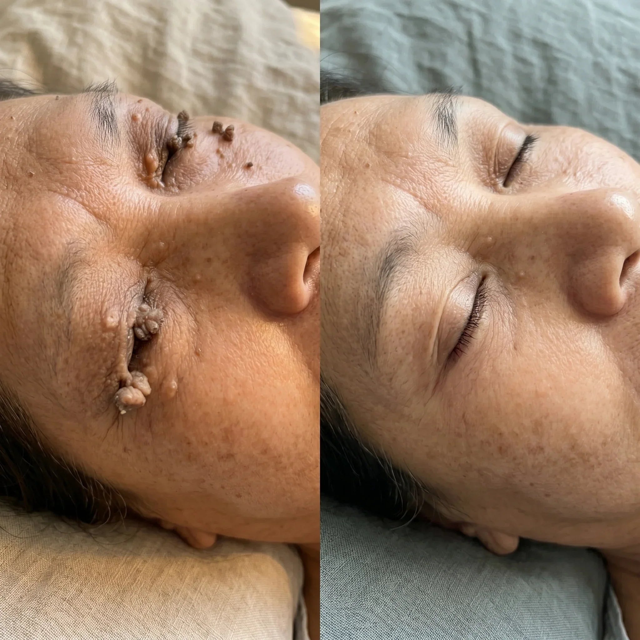 Customer before and after comparison showing skin around the eye area