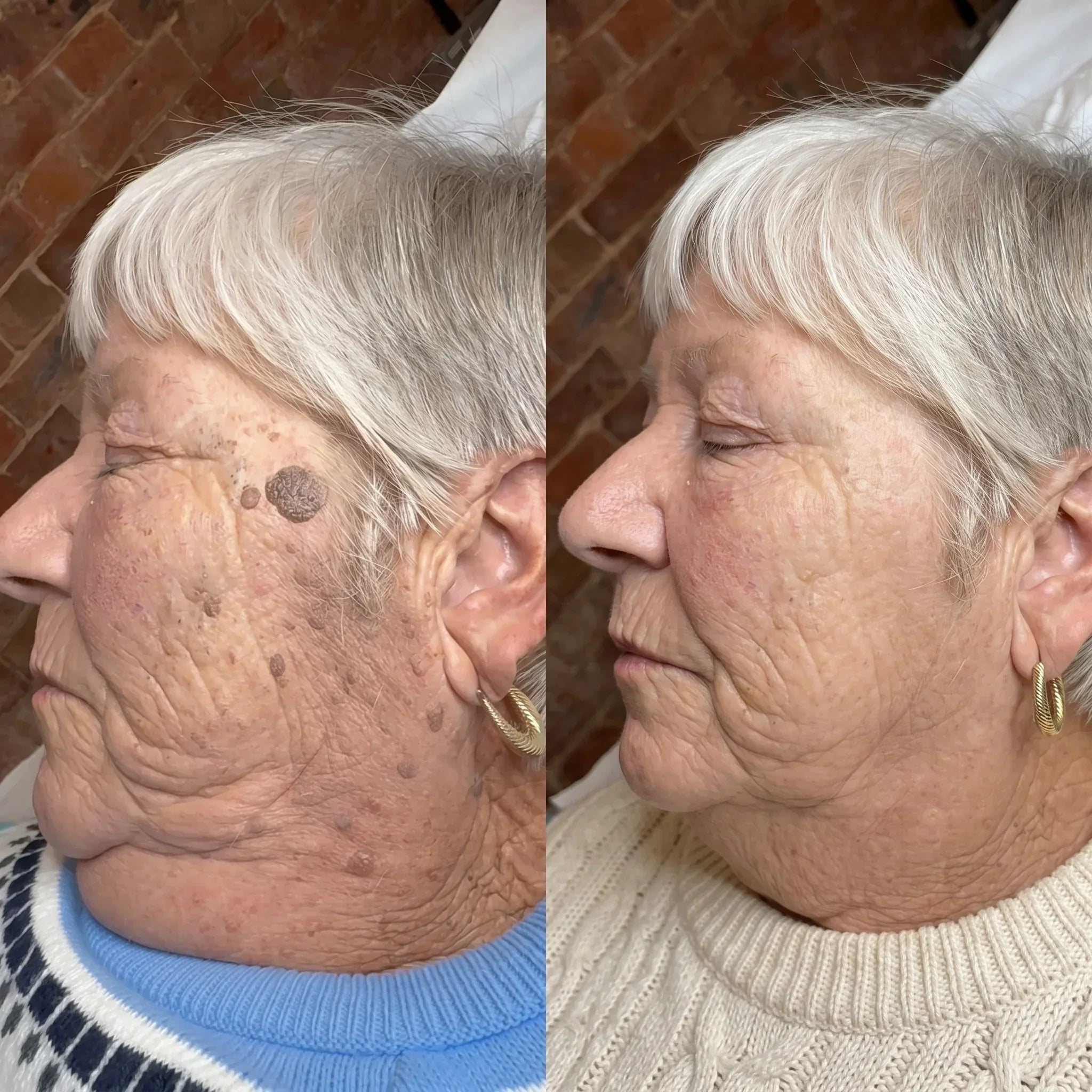 Customer before and after comparison showing facial skin