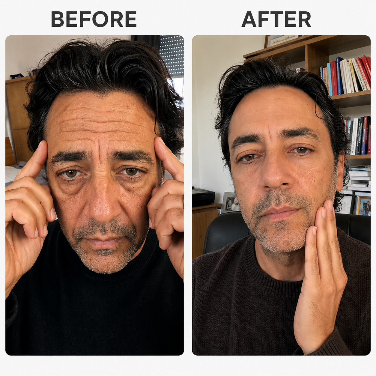 Customer before and after comparison showing facial fine lines