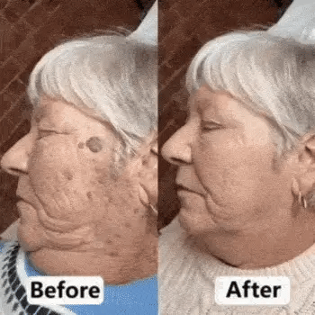 Gopuremagy before and after
