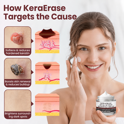 Last Day-Buy 1 Get 1 Free💙KeraErase Dual-Action Renewal Cream