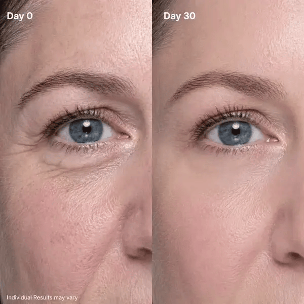 ⏳🔥Last Day-Buy 1 Get 1 Free🔥⏰P7 Eye Renewal Crème