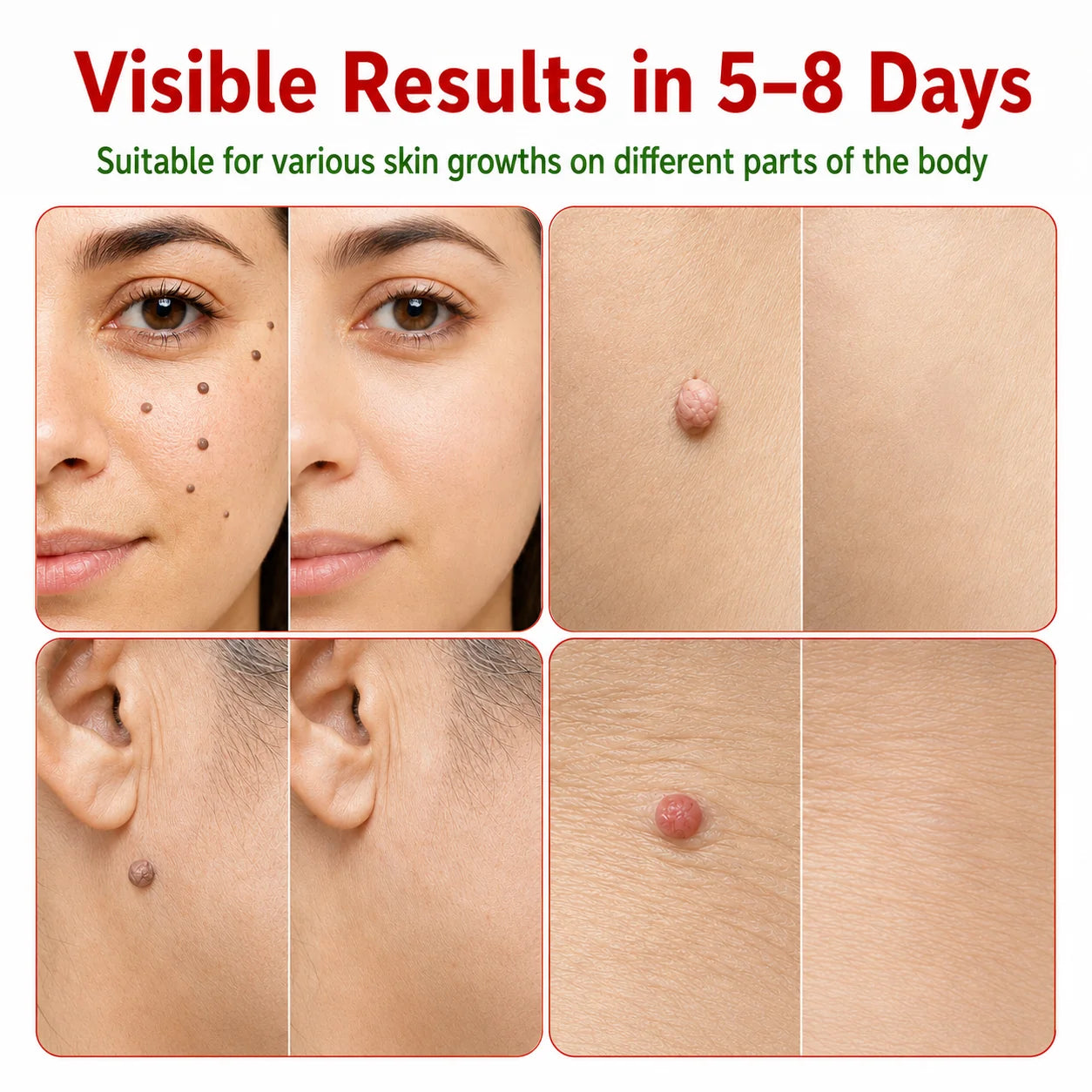Before and after examples of targeted skin spot care
